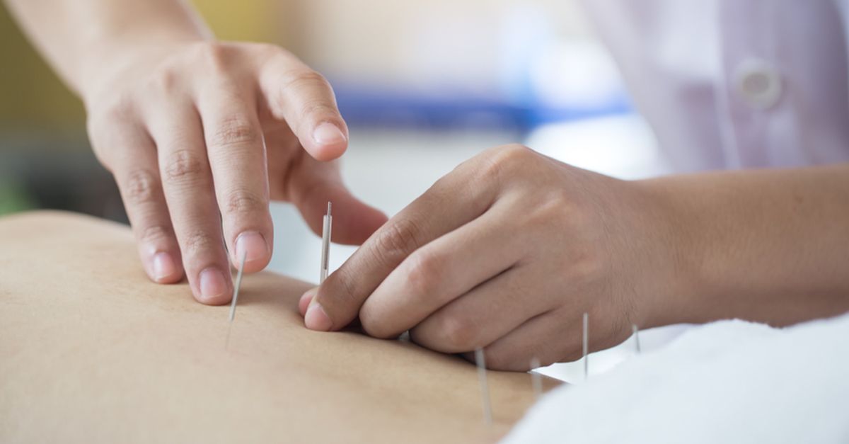 geburtsvorbereitung akupunktur