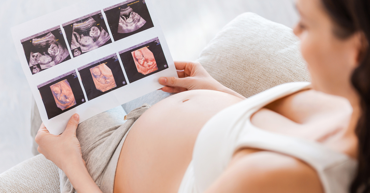 ultraschallbilder schwangerschaft