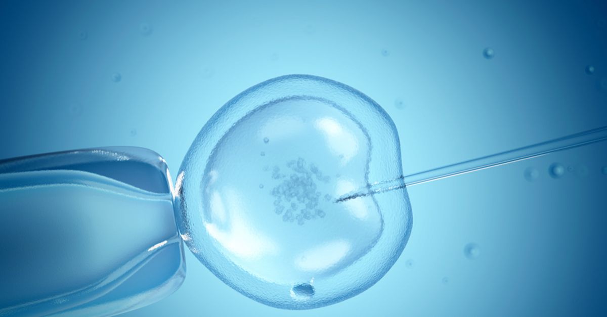 Schwanger durch IVF