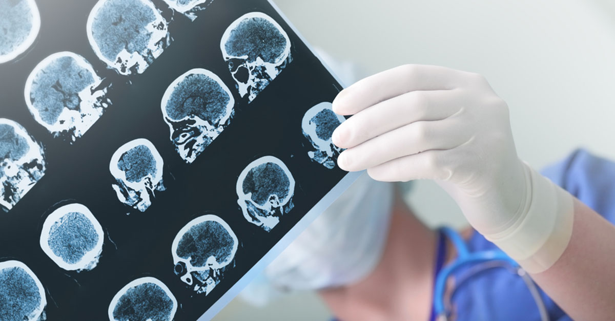 Epilepsie in der Schwangerschaft