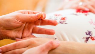 Akupunktur während der Schwangerschaft