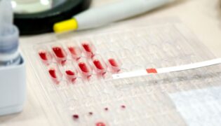 Rhesus-Unverträglichkeit und Schwangerschaft