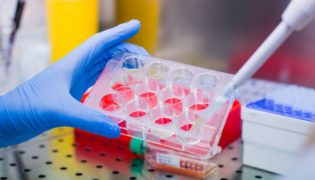 DNA-Tests: Wahre Wunder in der medizinischen Diagnostik