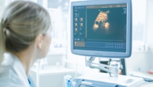 3D Ultraschall in der Schwangerschaft