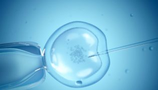 Schwanger werden durch IVF - künstliche Befruchtung erklärt