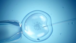 Schwanger werden durch IVF - künstliche Befruchtung erklärt