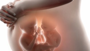 Mögliche Komplikationen in der Mehrlingsschwangerschaft